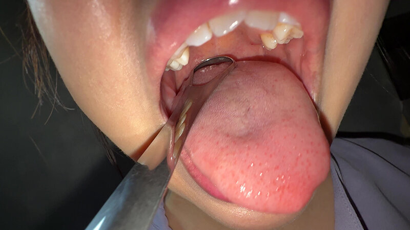 【個人撮影】谷田かりなの舌ブラシで「汚舌苔」採取 画像15